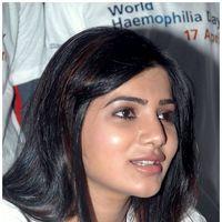 Hemophilia Press Meet By Samantha Pictures | Picture 420687